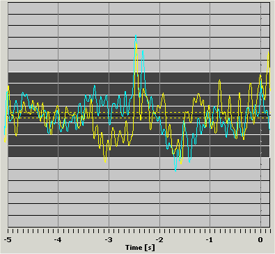 Noptel Bad Shot 2 (6).gif